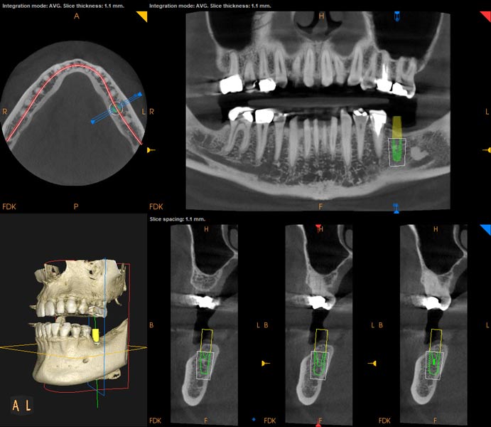 Dental technology at Cascade Dental 